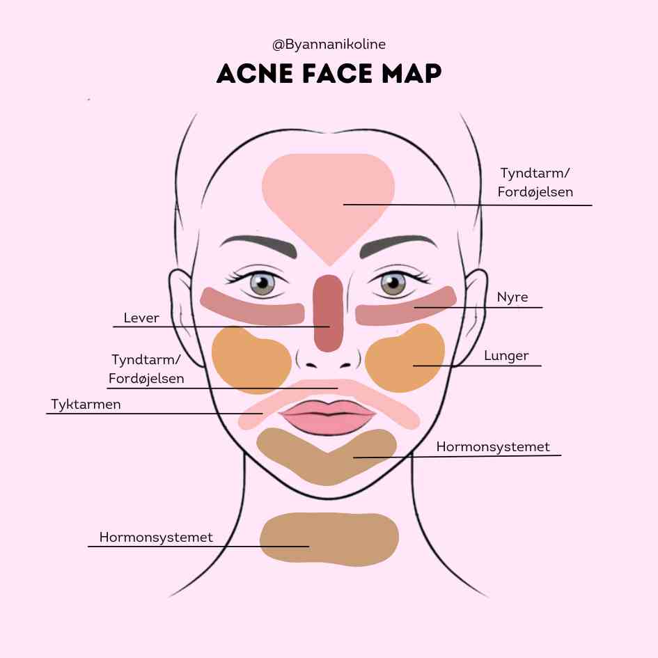 kort over acne face mapping