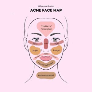 Et kort over acne face mapping