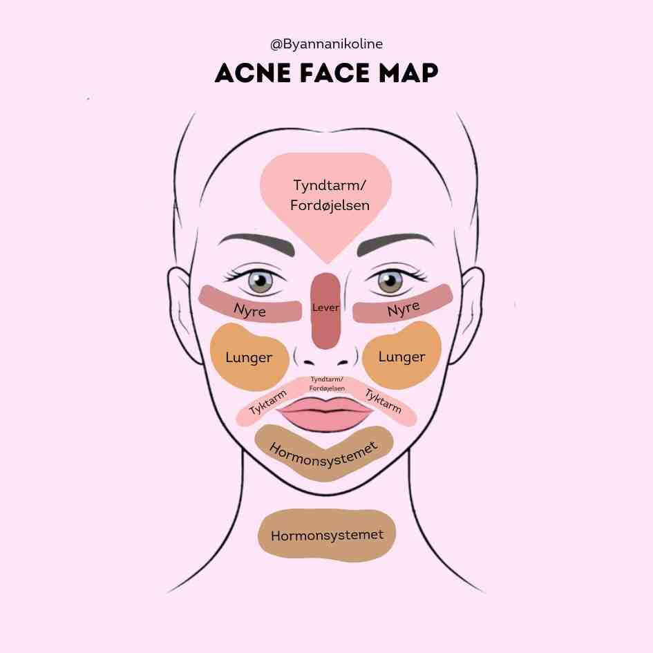 Et kort over acne face mapping
